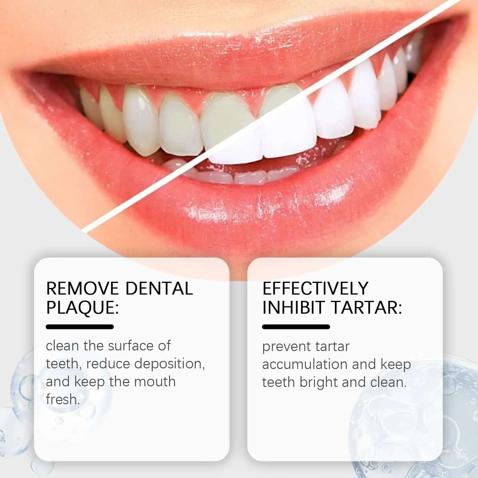 Oralhoe Whitening Tooth Care Toothpaste, Daily Gingiva Care Gently Cleans Stains And Tartar Freshen Breath - COLMAGIC