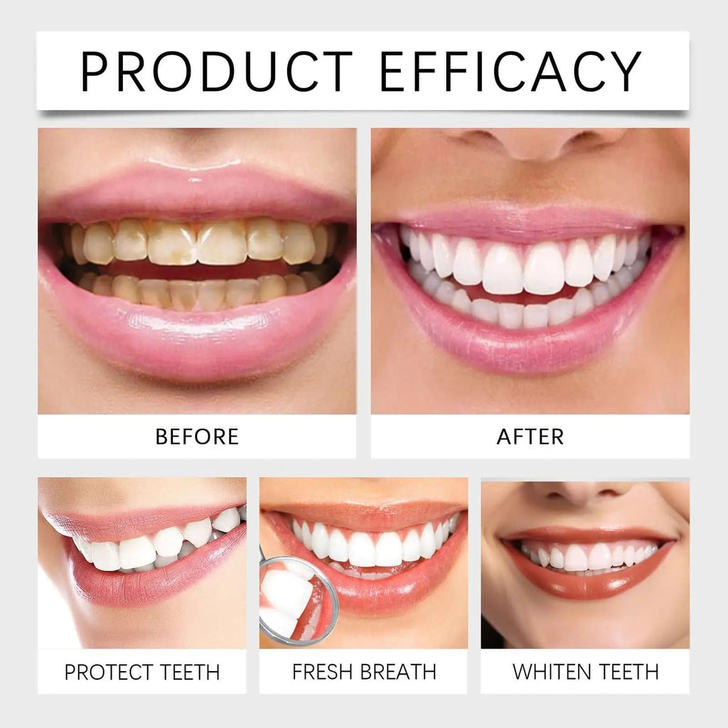 Oralhoe Whitening Tooth Care Toothpaste, Daily Gingiva Care Gently Cleans Stains And Tartar Freshen Breath - COLMAGIC